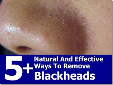 Natural and Effective Ways to Remove Blackheads!