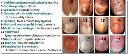 Are your fingernails healthy, or sending you a health warning?