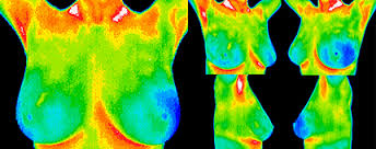 FDA Issues Warning To Holistic Thermography Doctor