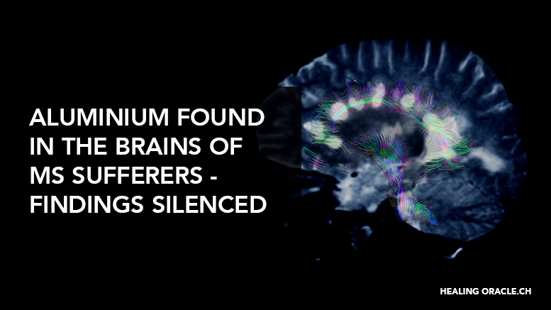ALUMINIUM FOUND IN THE BRAINS OF MS SUFFERERS – FINDINGS SILENCED