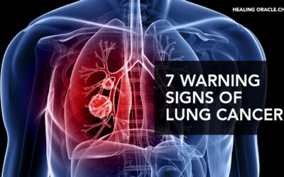 7 WARNING SIGNS OF LUNG CANCER YOU SHOULD NOT IGNORE!