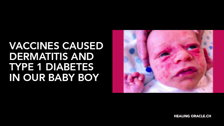VACCINES CAUSED DERMATITIS AND TYPE 1 DIABETES IN OUR BABY BOY
