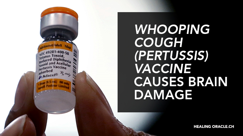 30-YEAR-OLD STUDY FOUND THAT THE WHOOPING COUGH (PERTUSSIS) VACCINE CAUSES PERMANENT BRAIN DAMAGE