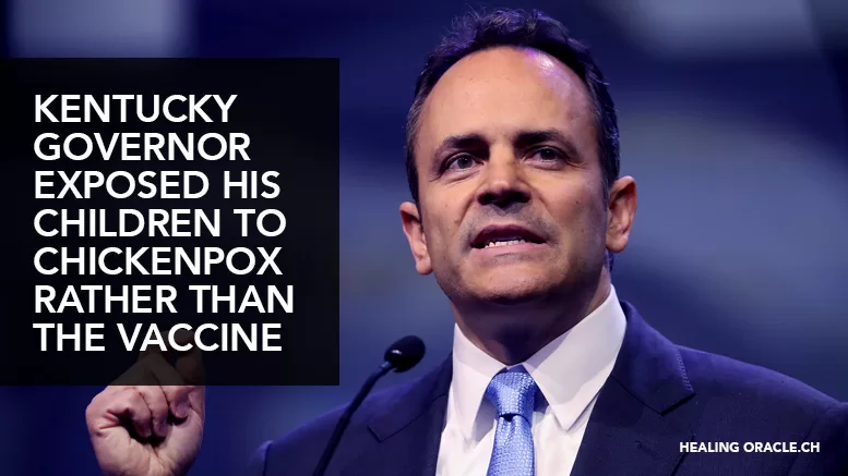 KENTUCKY GOVERNOR SAYS HE EXPOSED HIS CHILDREN TO CHICKENPOX RATHER THAN GETTING THEM VACCINATED