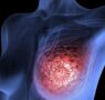 FENBENDAZOLE / MEBENDEZOLE HAVE BEEN CLINICALLY PROVEN TO HELP WITH LUNG & BREAST CANCER