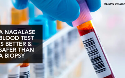 NAGALASE BLOOD TEST CAN DETECT THE PRESENCE OF CANCER AND OTHER AUTOIMMUNE DISEASES WITHOUT A BIOPSY