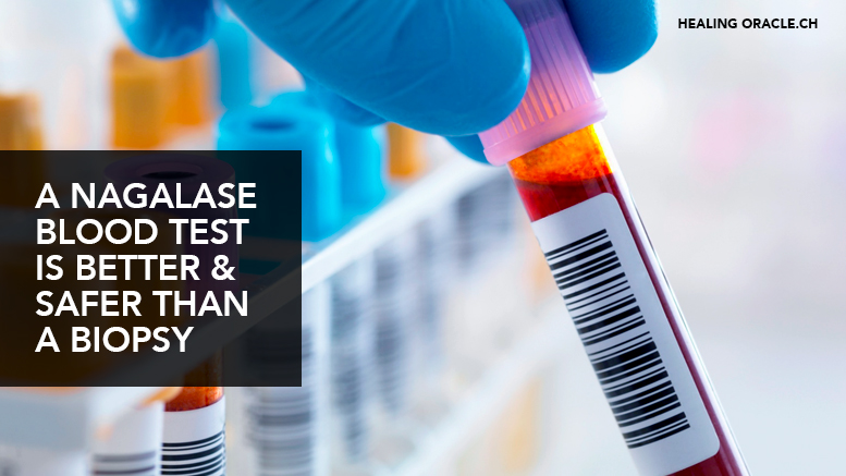 Nagalase blood tests are far better and safer than a biopsy