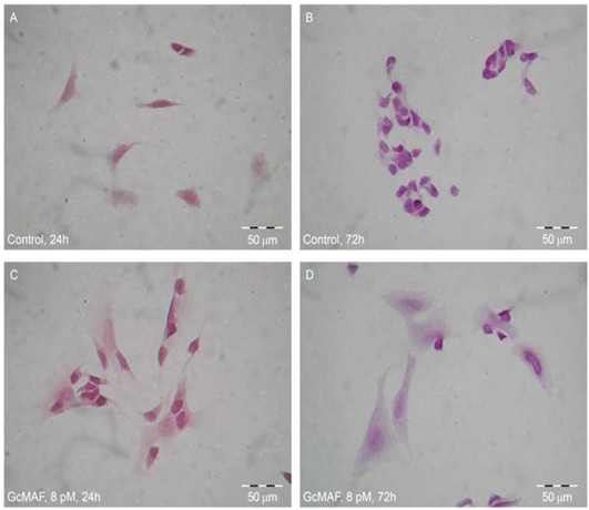 The human SH-SY5Y neuronal cells cultured in the absence and presence of GcMaf (VDTP)