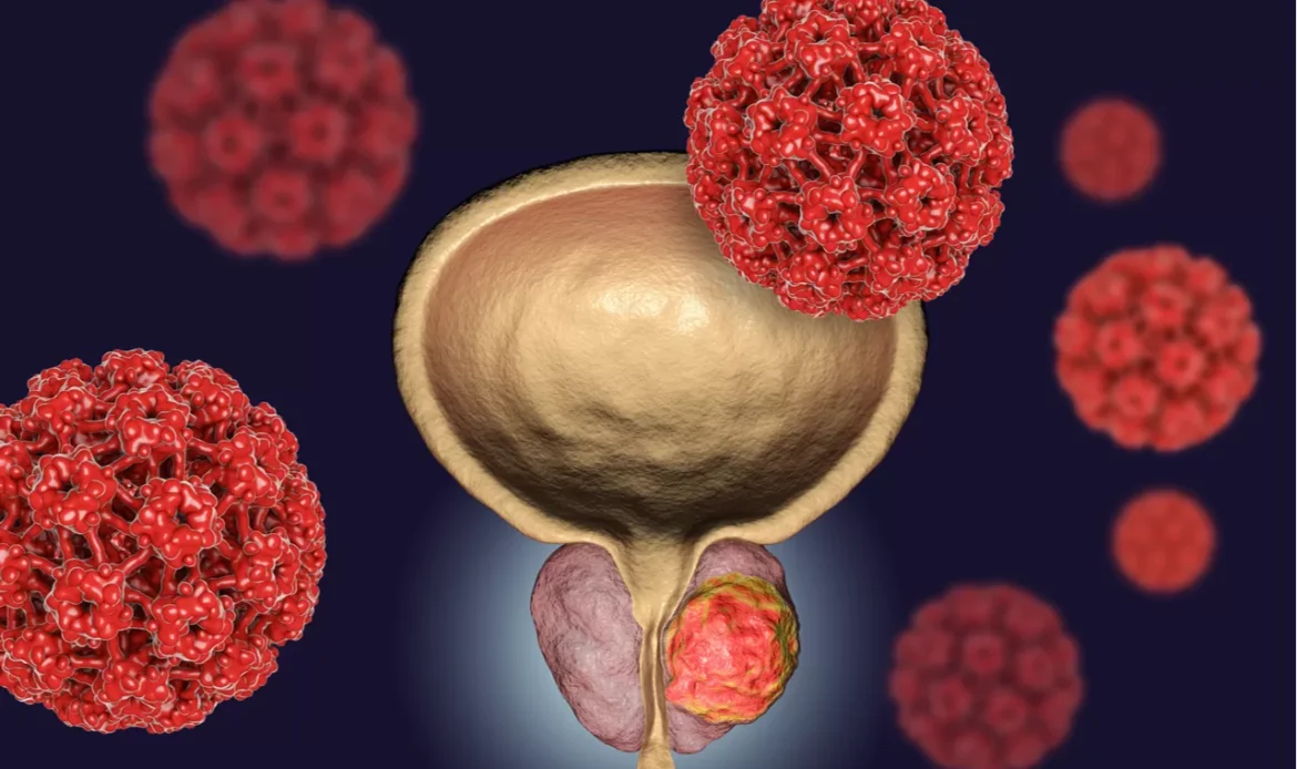 IMMUNOTHERAPY FOR PROSTATE CANCER WITH VDTP/GC-MAF